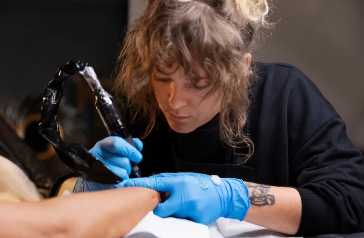 Chicago tattoo removal